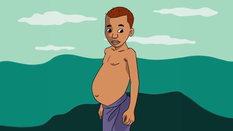 Kwashiorkor